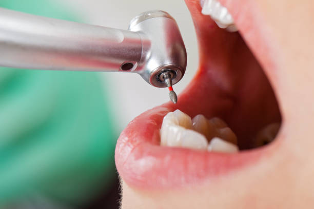 Professional Emergency Dental Service in NJ